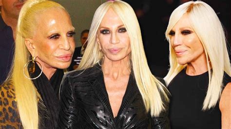 what happened to donatellas face